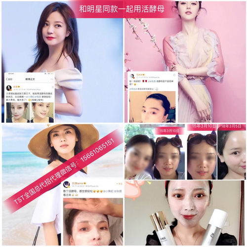 ΪʲôҪѡTSTƷ|ô|Ҫʲô