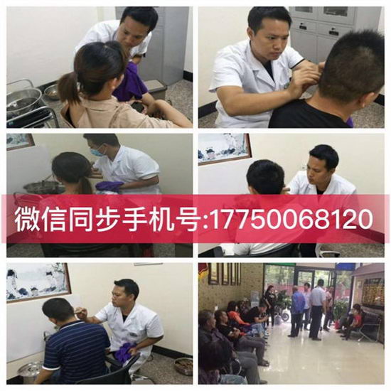 面瘫三个月以上还能好吗?泉州哪里可以治疗