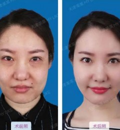 �������ҽԺ������ Ϊ�����ӷ֣������������Լ�