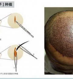 �����Ʒ�ԴΪ���������ֲ��������΢��ֲ��