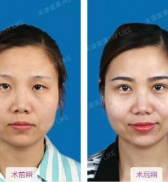 ���������˫��Ƥ���� ��ܰ��Ц�� ϸ�ĺǻ�������