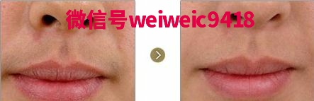 脱毛膏脱毛膏全国排行榜排名前十