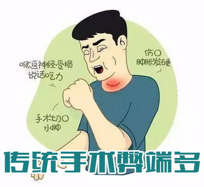 RFA超导可视针孔超微创术好不 帮你温和呵护甲状腺健康