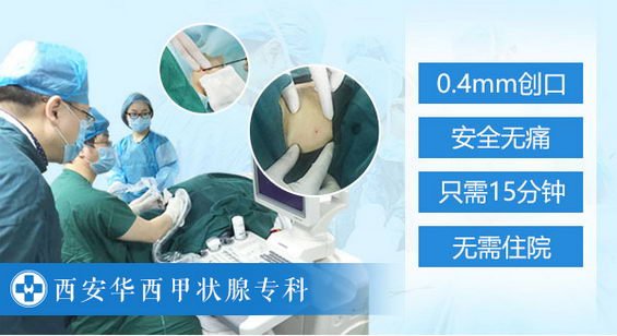 西安RFA甲状腺微创消融术,让甲状腺治愈率遥遥领先