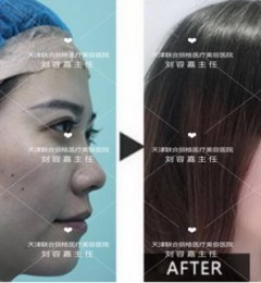 ��������������ݼ���ѿ����ʽ���ۺ���Ч���õ�����