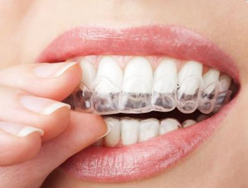 淮安诺贝尔口腔隐形矫正牙齿│牙齿矫正的理想选择!