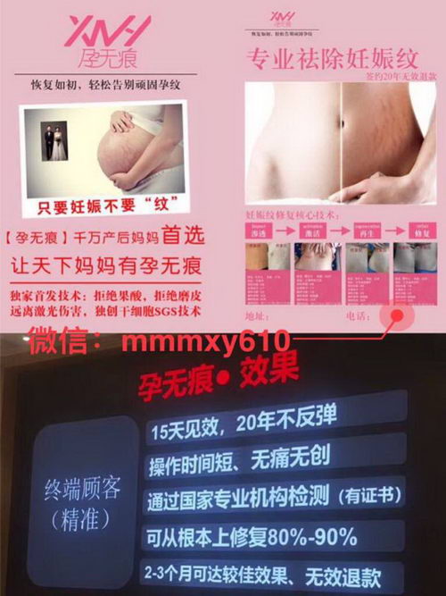 上海孕无痕哪家效果好?价格贵不贵?怎么联系呢