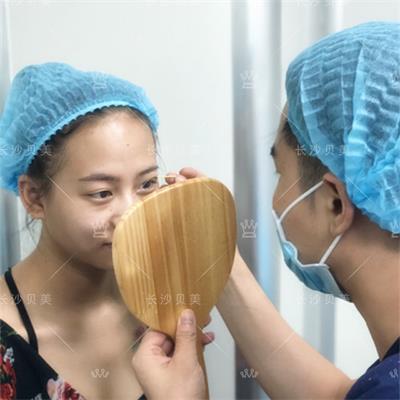 长沙贝美冯涛院长/双眼皮术后多久能恢复?几天可以沾水?