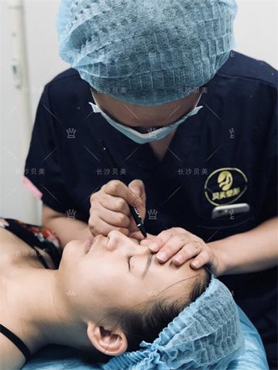 长沙贝美冯涛院长/双眼皮术后多久能恢复?几天可以沾水?