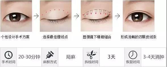 长沙贝美冯涛院长/双眼皮术后多久能恢复?几天可以沾水?