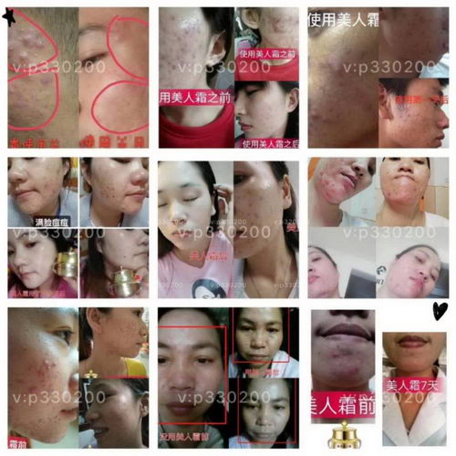 田林草本美人霜一瓶能用多久效果真的那么好吗?安全吗?