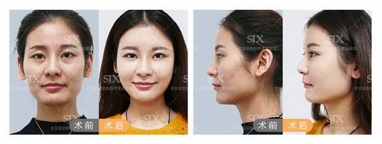 邱立东:毕业季整容热,学生求美需谨慎!