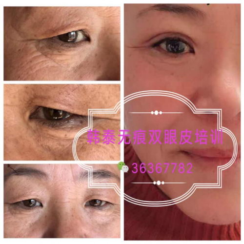 ֮һҵ޺˫Ƥ--̩޺˫Ƥѧϰıؿ