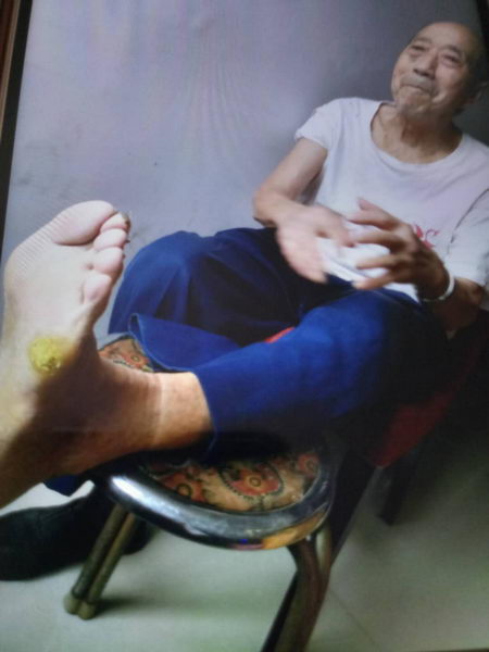 “圣禾灵”降糖产品糖尿病案例——徐道本