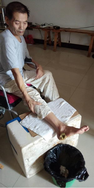 “圣禾灵”降糖产品糖尿病案例——徐道本