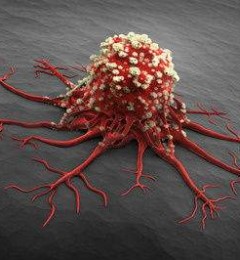 NK／T细胞淋巴瘤复发还有救吗