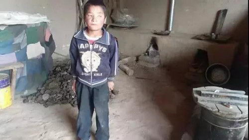 爱尔眼科医院是正规吗?“自己的角膜移植给自己”,八岁藏族男孩重获光明