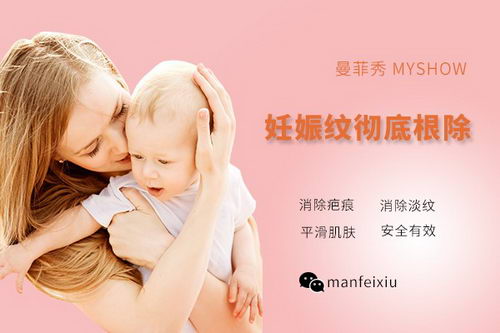 有什么产品能去除妊娠纹 出乎意料的祛纹技巧