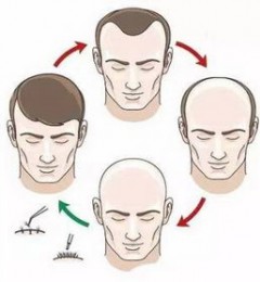 ��������ֲ����������Ŀ������ë�Ҽ�⣿