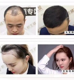 ֲΪÿλṩ5ԪֲգЧ