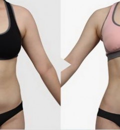 ����֬���ѻ�---����Ů�����⣬����������ۼ��֬��Ϊ������