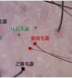 ʲô��ë��ή����ʲô��ë�һ����������ȷӦ�ԣ�