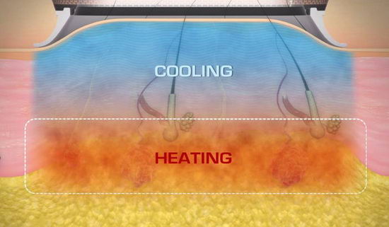 miraDry΢Ҹ޵ֹ뾻ζ¿Ƽ йҽ