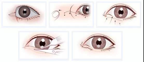 ϺõҽԺ޹ΰҽ˫Ƥָܿ