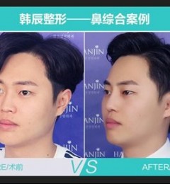 �人����רҵƷ�ʣ��ӱǼ⿪����������