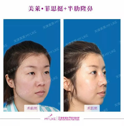 ҽԺ濿 Ӳ̱ɱС̱ǵϮ