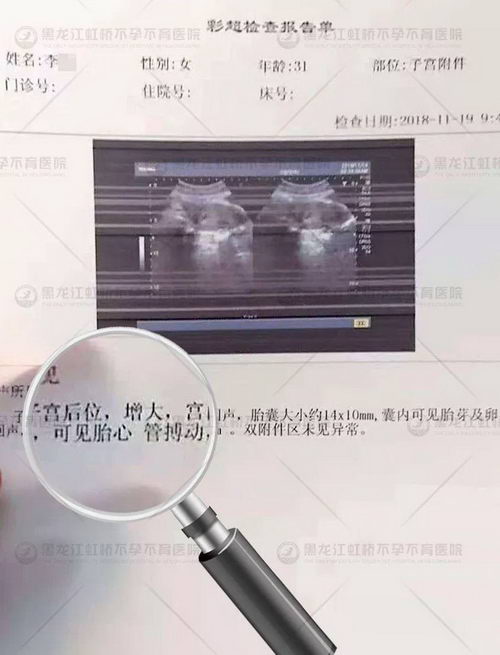 黑龙江虹桥医院收费贵吗 百姓消费起的平价医疗