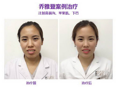 天津伊美尔乔雅登玻尿酸三周年私享沙龙圆满落幕