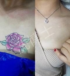 ϴ��ʿƤ��ϴ�����������������Ŀ���