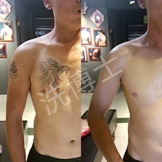 洗博士皮秒洗纹身带给肌肤重生的可能