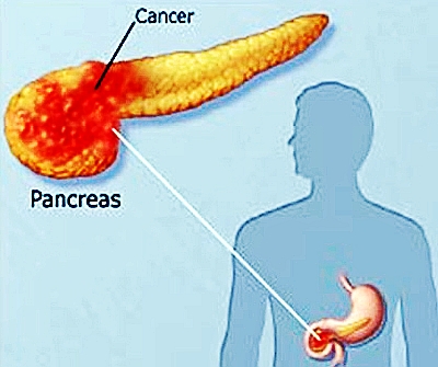 ˹ҽѧԺоԱ ӹշٰҪ