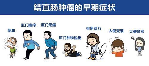 肠癌发病率逐年攀升,徐州肛泰中医院:你为自己做过肠镜吗?