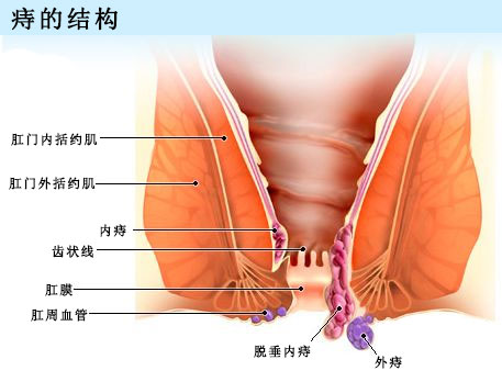 广州东大医院评价 99%的人都不知道，身为痔疮也有“苦衷”