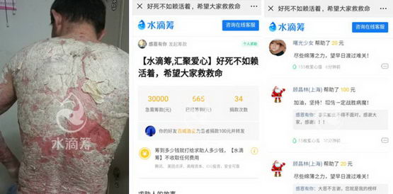 ϺƤҽԺ֢мͨˮγ