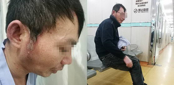 ϺƤҽԺ֢мͨˮγ