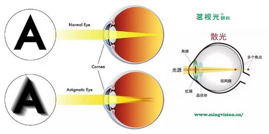 ӹۿƸ߶ȽӼӸ߶ɢĽΰ