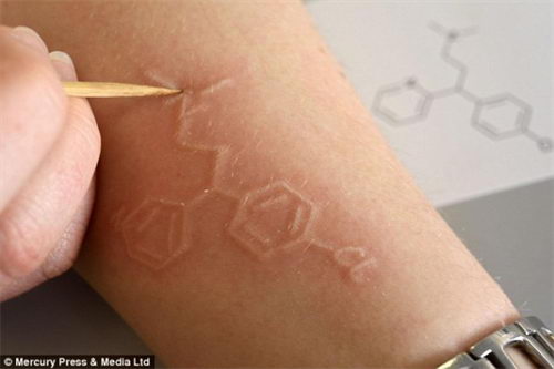 荨麻疹怎么治好?-我已治好我来说