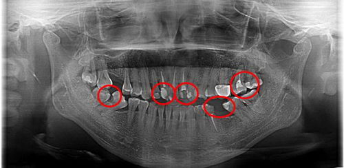 牙齿,需要仪式感