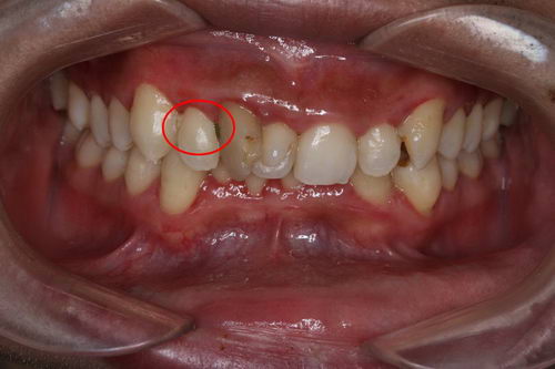 牙齿,需要仪式感