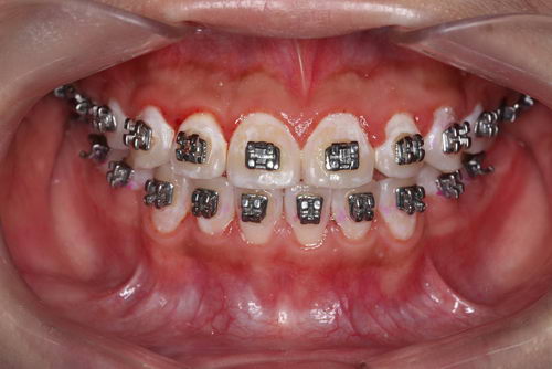 牙齿,需要仪式感