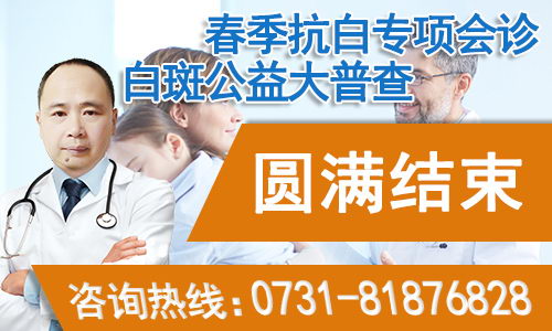 长沙华山白癜风医院好不好?助力春季祛白