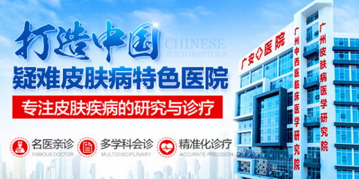 治疗疱疹_选择广州皮肤病医学研究院刘成坤主任