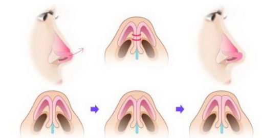 上海玫瑰女子医院口碑行不行 让求美者得偿所愿