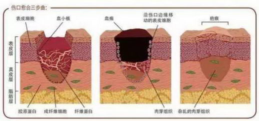 北京伊美尔健翔医院:疤痕该如何区分