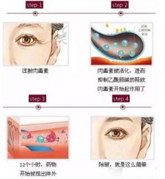 ��������������ҽԺ���ⶾ��ע�������ô��