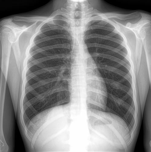 动态DR,赋能助力乡镇医院升级